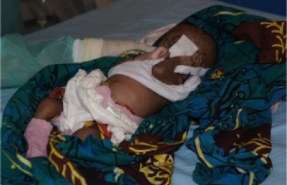 Restablecimiento y refuerzo a los servicios de salud materno-infantil del St. John of God Catholic Hospital de Mabesseneh-Sierra Leona