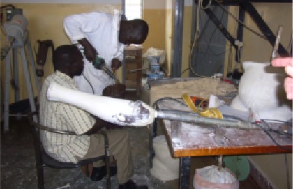 proyecto de rehabilitación médica en Gulu (Uganda)